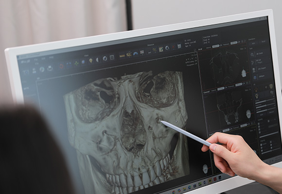 3D CT 분석