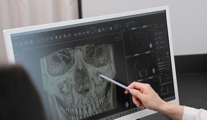 3D CT 분석
