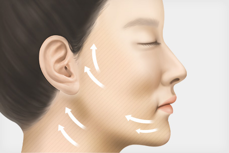 수술 전, 디자인