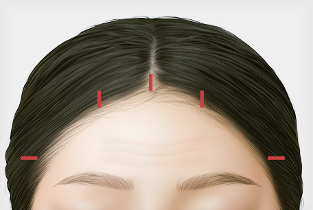 STEP 01