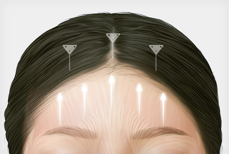 STEP 03