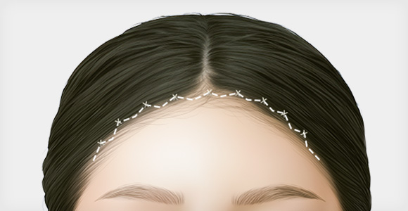 STEP 04