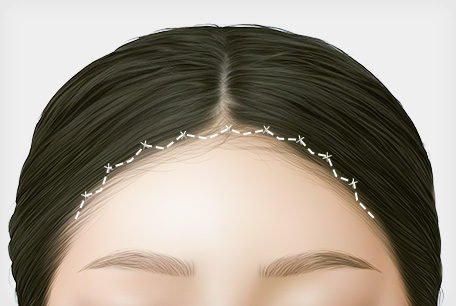 STEP 04