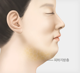피하지방층