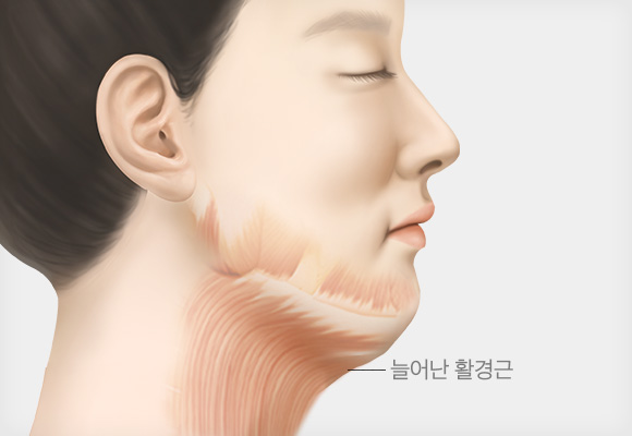 활경근