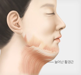 활경근