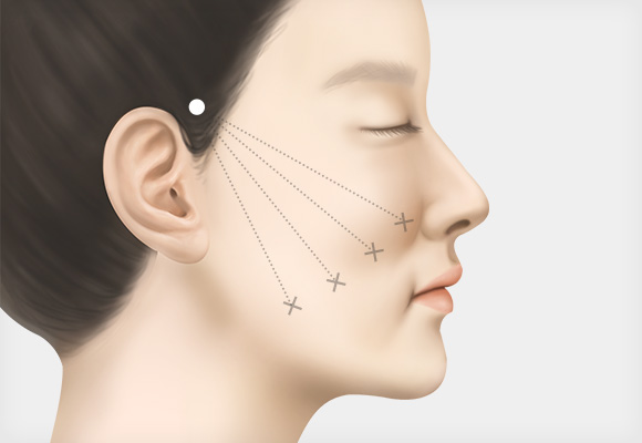필요한 부위와 방향을 디자인