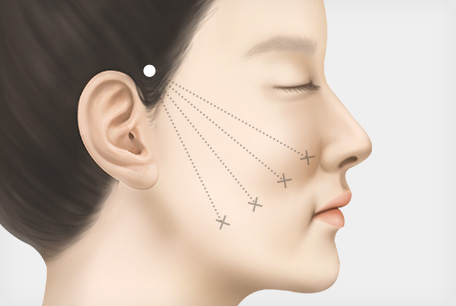 필요한 부위와 방향을 디자인