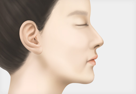 수술 탄력을 회복