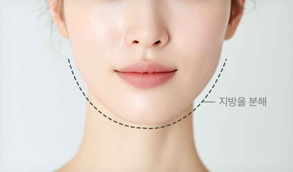 윤곽주사