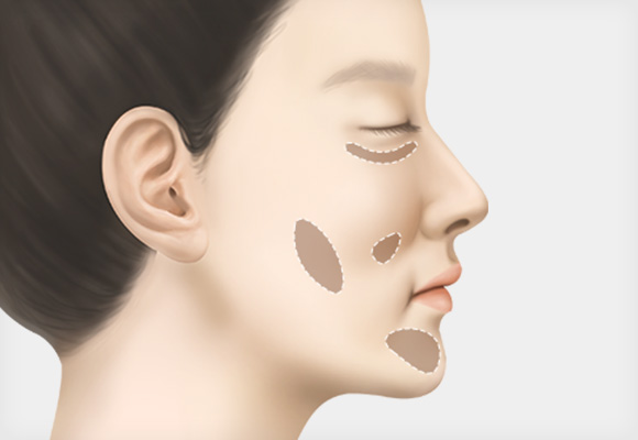 1:1 상담