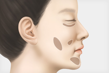 1:1 상담