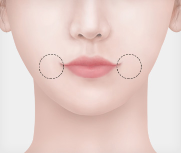 STEP 01