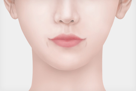 입꼬리 보조개