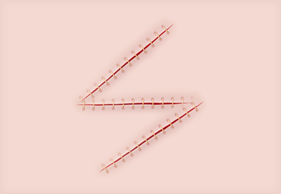 STEP 02
