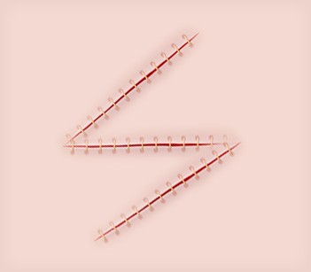 STEP 02
